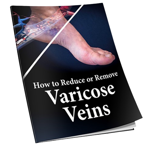 Varicose 911 Bonus 2